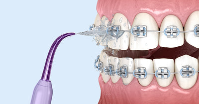 HOW TO USE A WATER FLOSSER WITH BRACES?