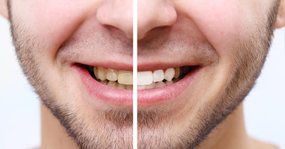 HOW TO WHITEN YOUR TEETH AT HOME