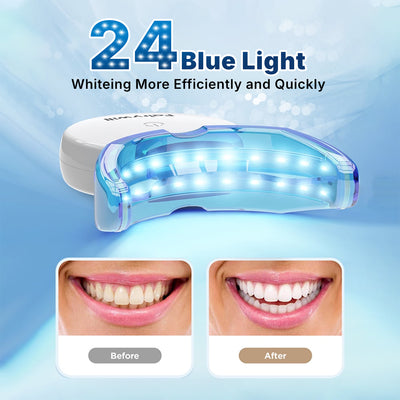 Fairywill Teeth Whitening Strip Kits, 16Min Rapid White Rechargeable Teeth Whitener Case,24pcs LED Blue Light and 28 White Strips for Sensitive Teeth